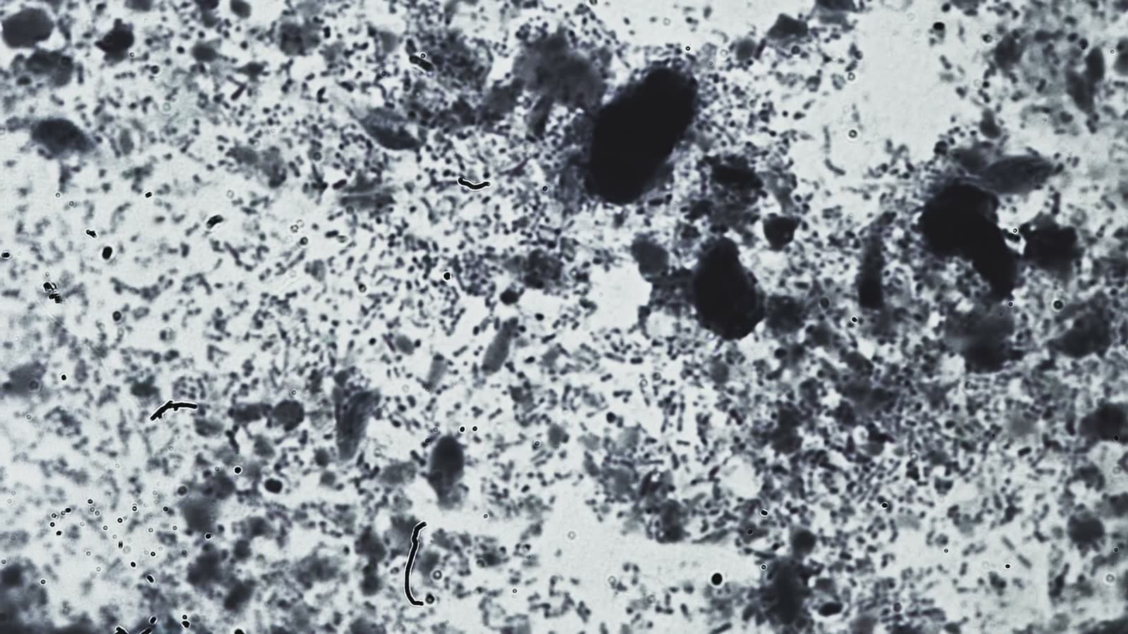 microorganisms-and-bacteria-moving-under-a-microsc.mp4
